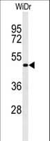 GATA6 Antibody (aa254-279)