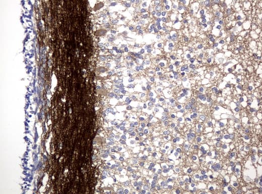 L1CAM Antibody (clone UMAB47)