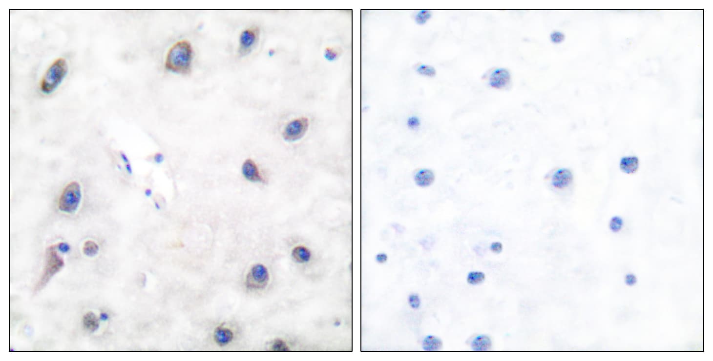 PPP1R1B / DARPP-32 Antibody (aa18-67)