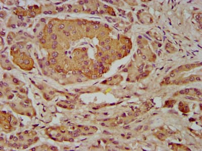 Polyclonal Rabbit anti-Human INPP5B Antibody (IHC, IF)