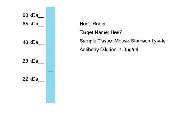 Polyclonal Rabbit anti-Mouse HES7 Antibody (aa67-116, WB)