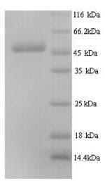 Human EFTU / TUFM Protein (Recombinant 6His, N-terminus)