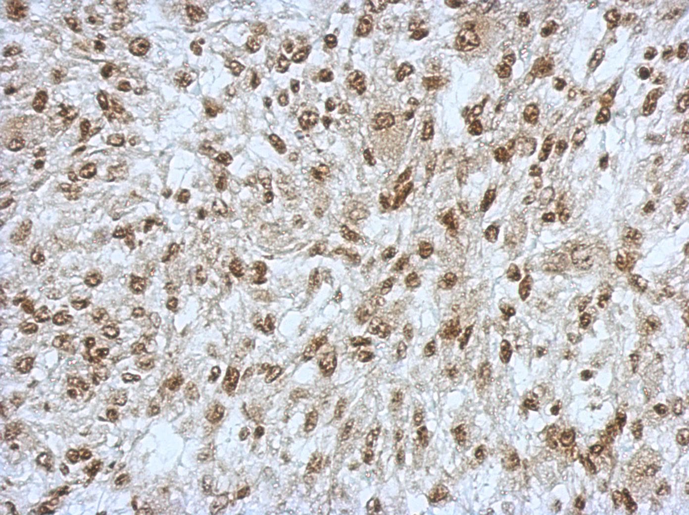 Polyclonal Rabbit anti-Human SAP130 Antibody (N-Terminus, IHC, WB)