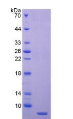 Human C4BPA / C4BP Alpha Protein (Recombinant His)