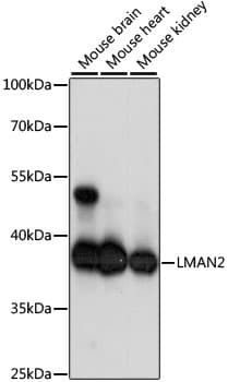 LMAN2 / VIP36 Antibody