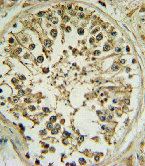 WNT1 Antibody (aa260-288)