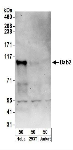 Polyclonal Rabbit anti-Human DAB2 Antibody (aa275-325, WB)