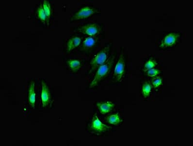Polyclonal Rabbit anti-Human DHRS3 / SDR1 Antibody (IHC, WB)
