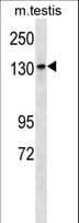 PEAK1 / SGK269 Antibody (aa1188-1216)