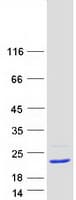 Human RPS25 / Ribosomal Protein S25 (Recombinant Myc-DDK (Flag))