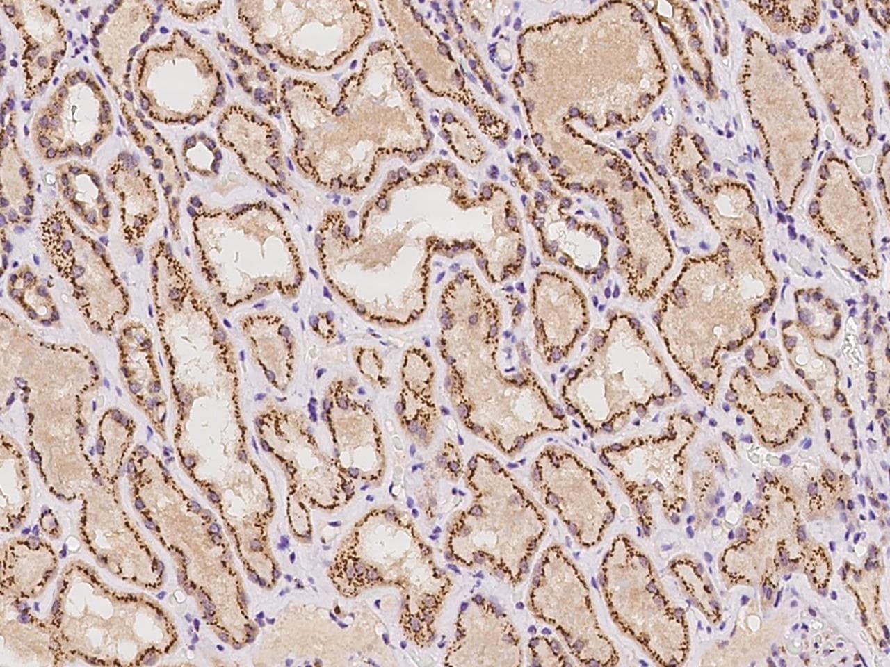 YIPF4 Antibody