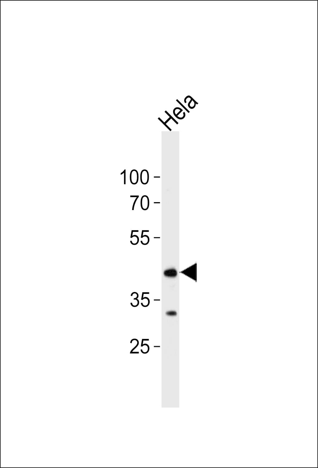 Polyclonal Rabbit anti-Human MAPK8 / JNK1 Antibody (Thr183/Tyr185, IHC, WB)