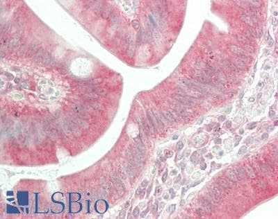 IHC-plus™ ANGPT1 / Angiopoietin-1 Antibody (aa158-207)