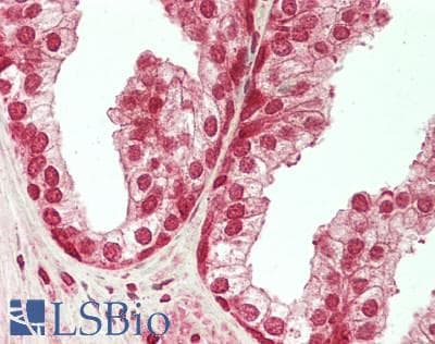 IHC-plus™ PBRM1 / BAF180 / PB1 Antibody (aa1-50)