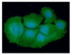 Monoclonal Mouse anti-Human VTA1 Antibody (clone AT14G10, WB)
