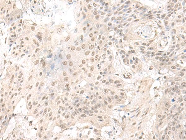ILKAP Antibody