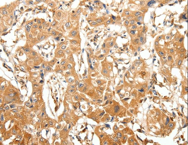 SLC27A1 / FATP Antibody