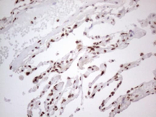HNRNPL / hnRNP L Antibody (aa270-502, clone OTI4E5, Carrier-free)
