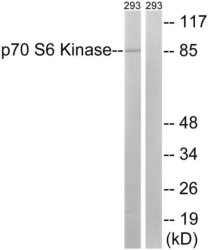 RPS6KB1 / P70S6K / S6K Antibody (p427)