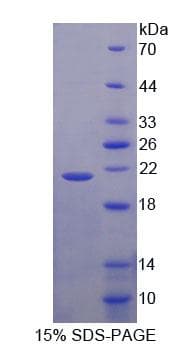 Human NBL1 / DAN Protein (Recombinant His-T7)