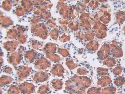 CDCP1 Antibody (aa689-836, APC)