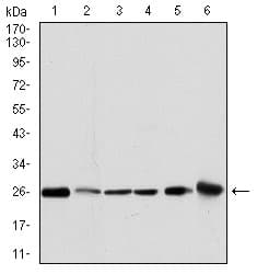 GSTM1 Antibody (clone 1H4F2)