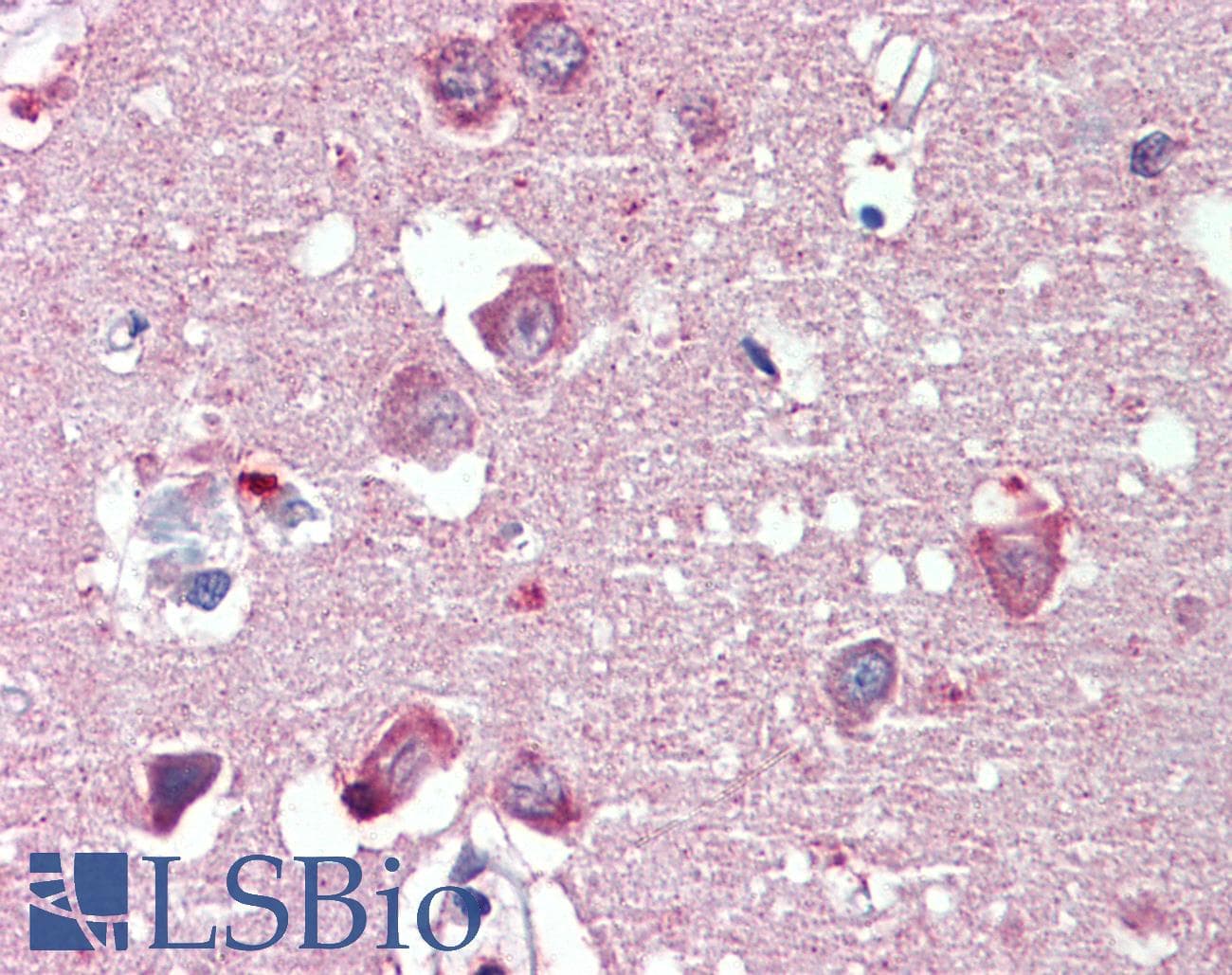 IHC-plus™ RTN4 / Nogo Antibody (aa501-515)