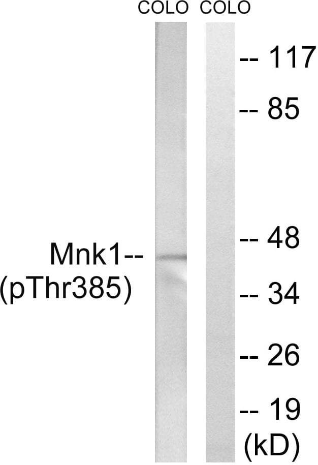 MKNK1 / MNK1 Antibody (phospho-Thr385)