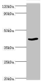 PRMT1 Antibody (aa20-353)
