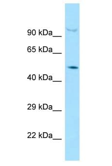 Polyclonal Rabbit anti-Mouse SMAD4 Antibody (aa389-438, WB)