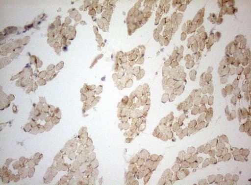 Adiponectin Antibody (aa19-244, clone OTI2G8)
