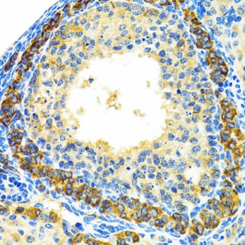 Polyclonal Rabbit anti-Human MRPL28 Antibody (IHC, IF, WB)