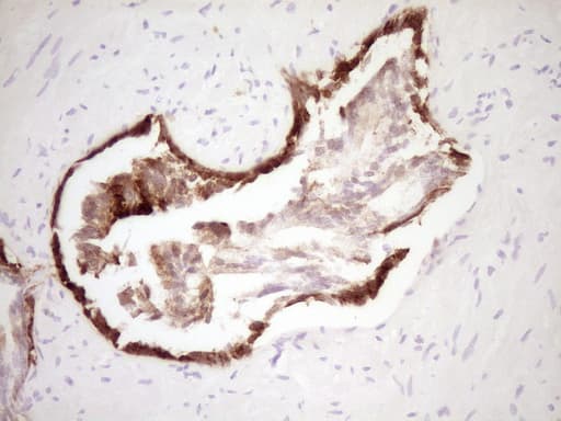 Monoclonal Mouse anti-Human KRT19 / CK19 / Cytokeratin 19 Antibody (clone OTI6A8, aa240-390, IHC, WB)