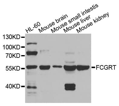 IHC-plus™ FCGRT / FCRN Antibody