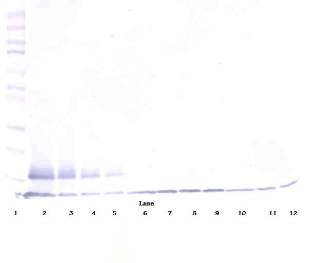 TNFRSF10B / Killer / DR5 Antibody