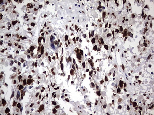 HNRPM / HNRNPM Antibody (aa1-261, clone OTI4C9)