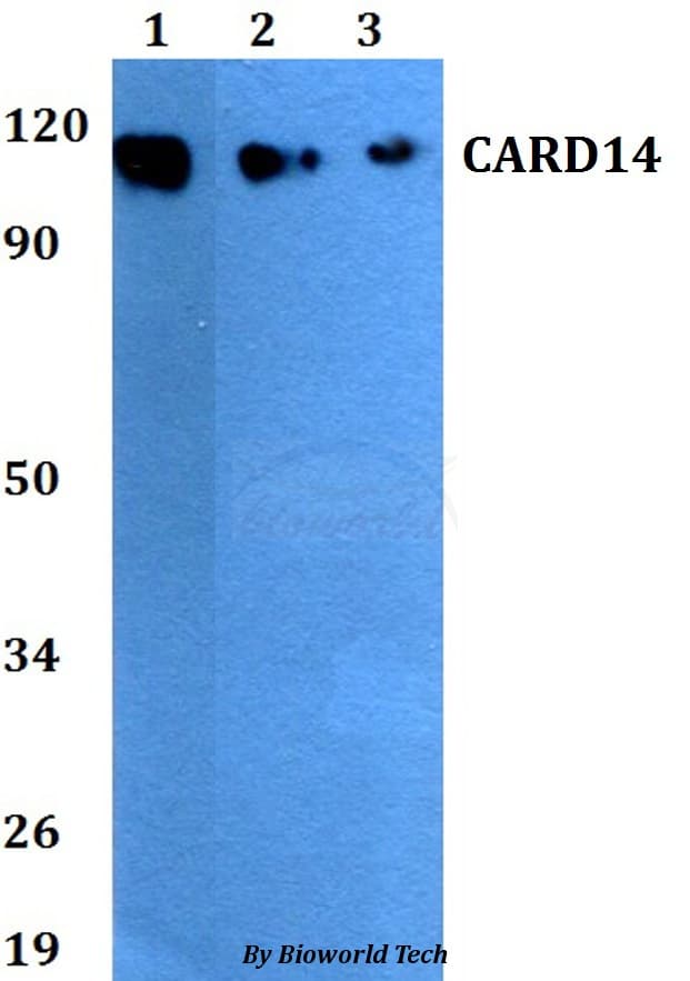 CARD14 Antibody