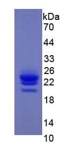 Mouse IFNAR1 / IFNAR Protein (Recombinant)