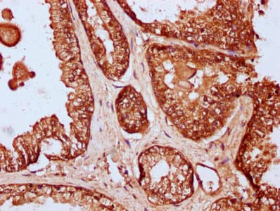 RIPPLY2 Antibody