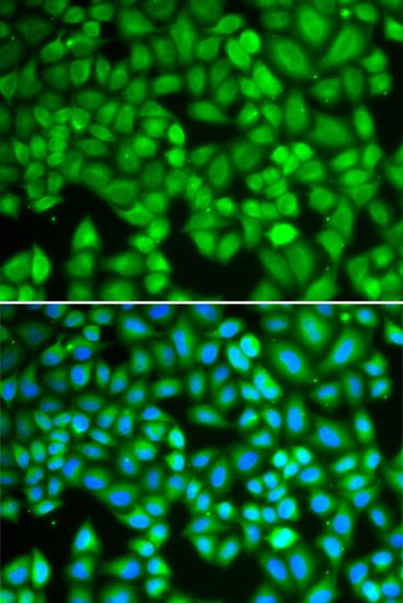 IHC-plus™ WAS / WASP Antibody