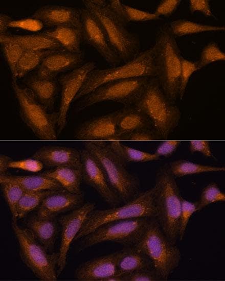 MAP2K3 / MEK3 / MKK3 Antibody