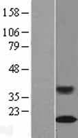 SLC50A1 / SCP Protein (Over-Expression Lysate Myc-DDK (Flag))