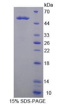 Human KLK14 / Kallikrein 14 Protein (Recombinant His-GST)
