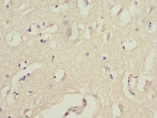 WNT7B Antibody