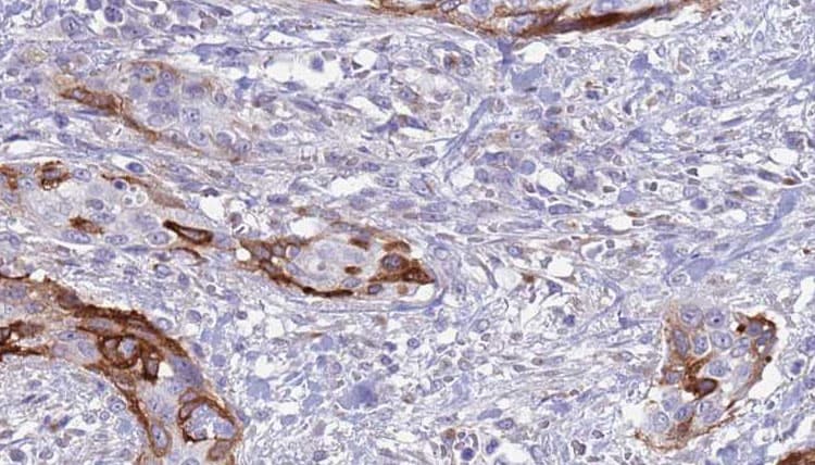 Polyclonal Rabbit anti-Human HBP17 / FGFBP1 Antibody (IHC, WB)