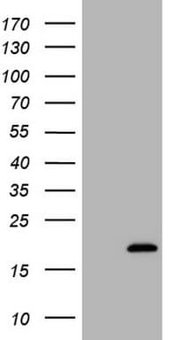 CALCA Antibody (clone 2D10)