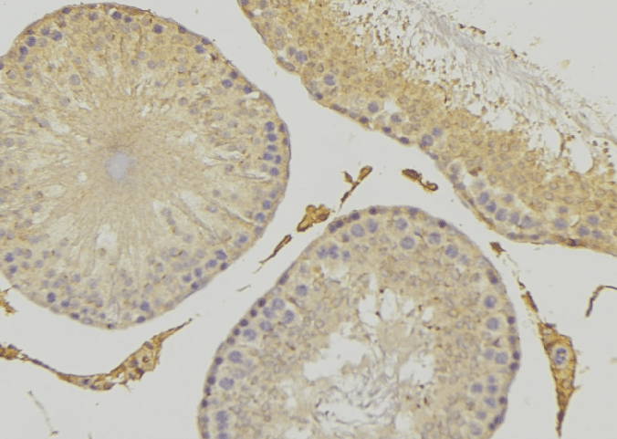 CEP41 / TSGA14 Antibody