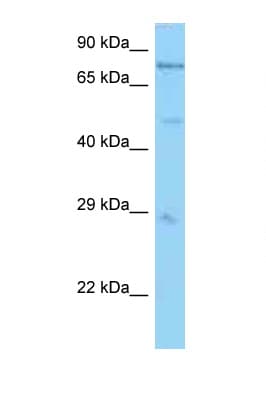 PSMC1 Antibody (aa71-120)