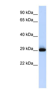 SUSD3 Antibody (aa35-84)