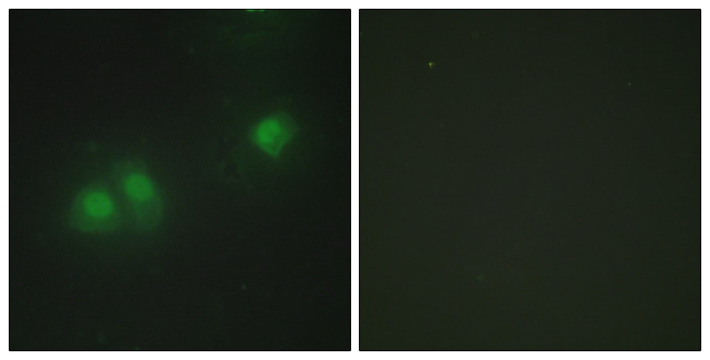 ELAV Like / ELAVL2 + ELAVL4 Antibody (Internal)